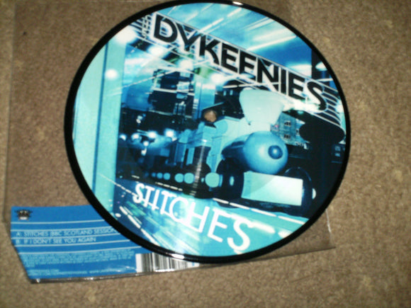 The Dykeenies - Stitches [BBC Scotland Session]